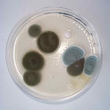 10 Reasons Why Do-It-Yourself (DIY) Mold Test Kits Are Not